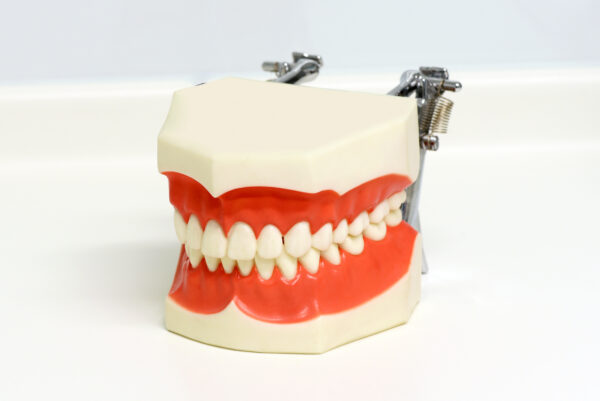 Dental model of upper and lower teeth