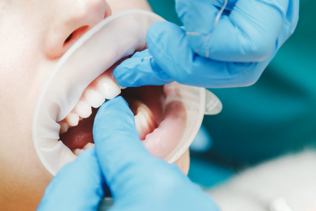 female-patient-dental-visit