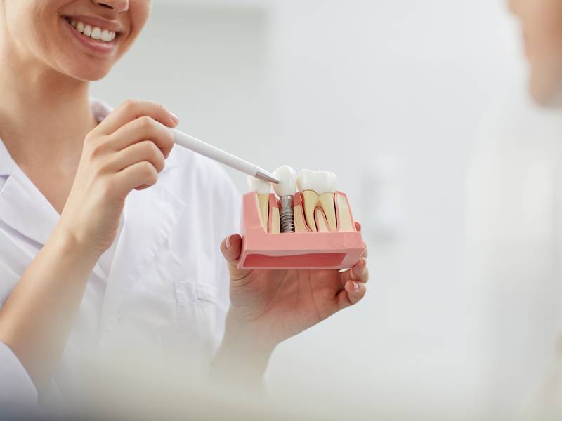 Could You Benefit From Dental Implants