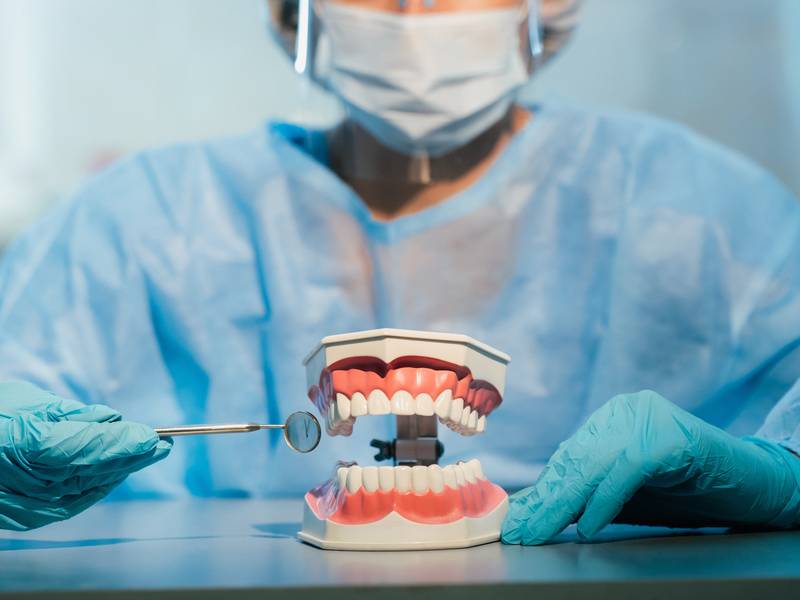 How Long Does A Dental Bridge Last?