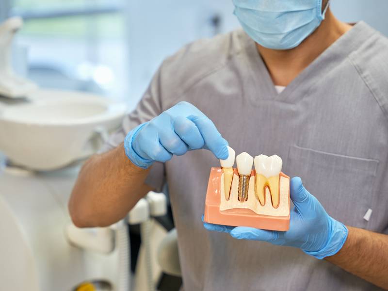 Are Dental Implants Permanent?