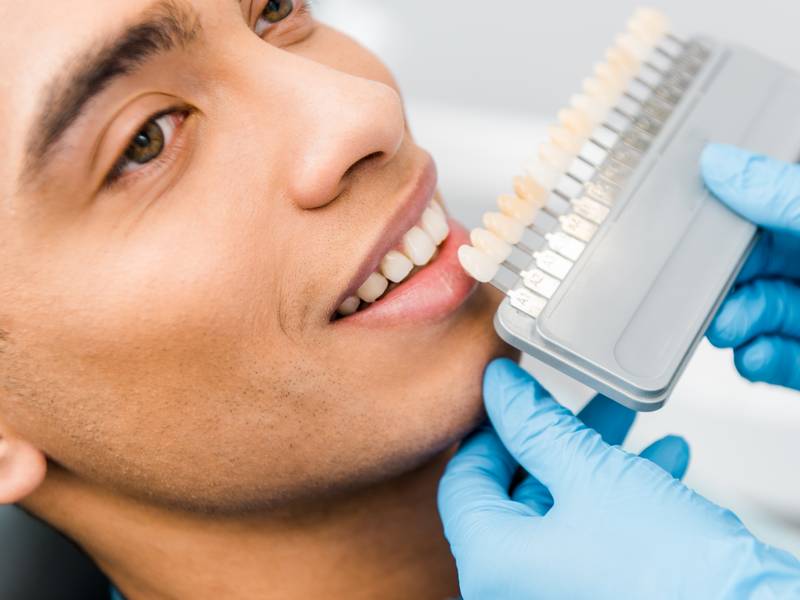 Is Teeth Whitening Safe?