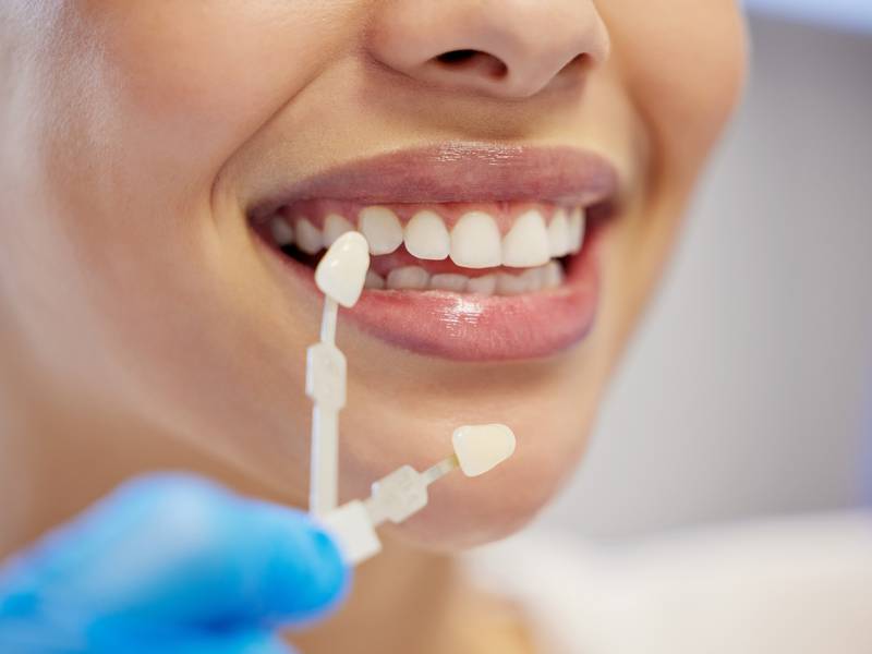 Can Cosmetic Dentistry Enhance My Smile?