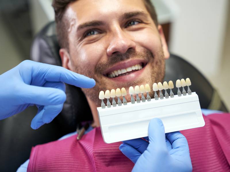 What Are Veneers?