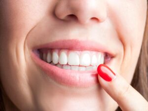 Teeth Whitening Amplifies Your Smile, Health, & Image