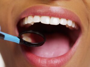 Choose the Top Local Dentist for Teeth Whitening
