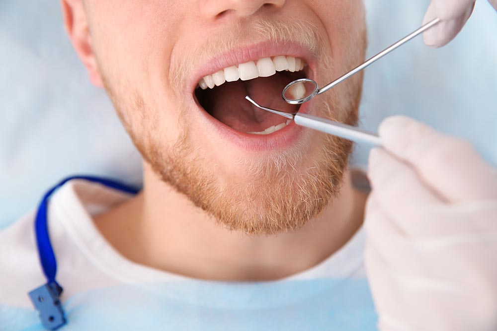 Dental Fillings for Effective Tooth Restoration