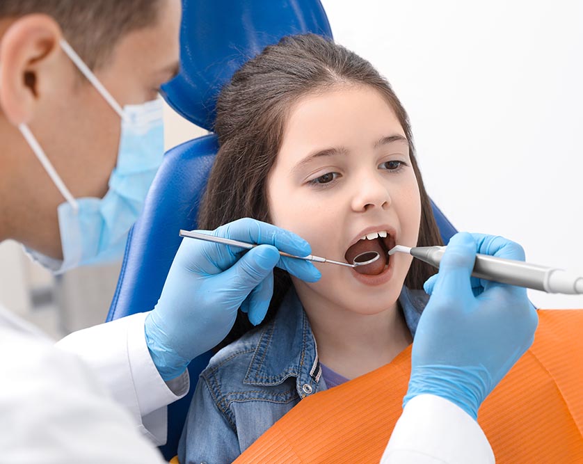 Dental Sealants for Long-Term Cavity Prevention