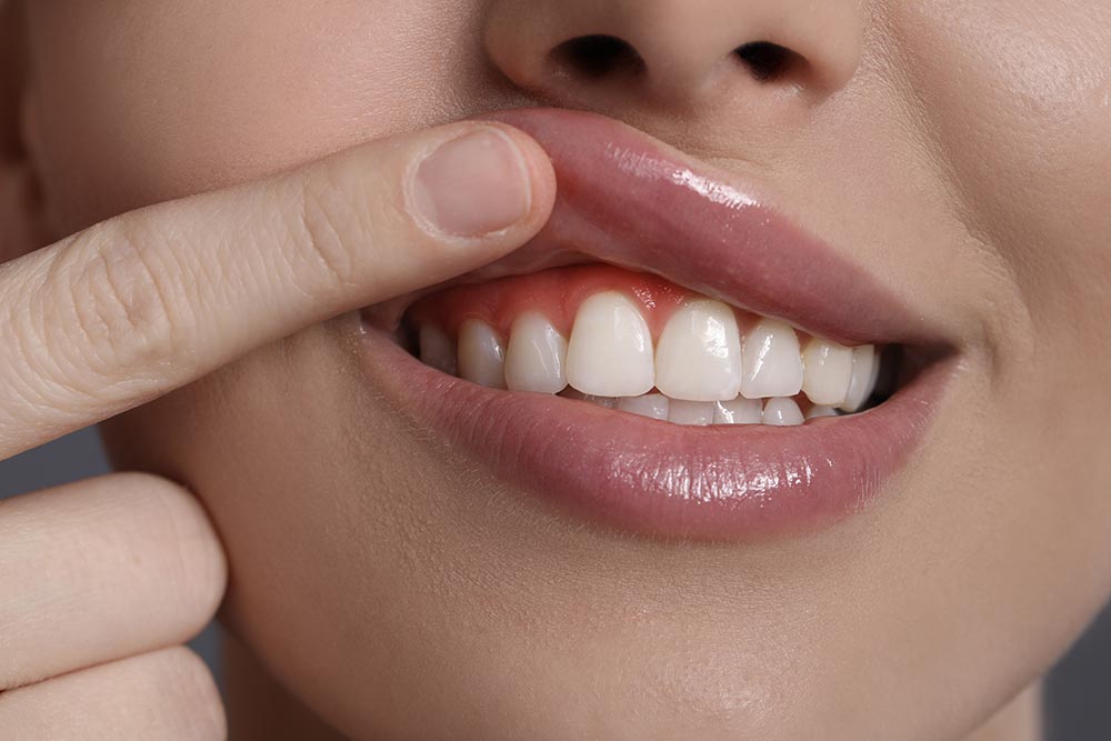 Periodontal Disease Therapy at AH Dentistry
