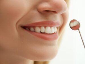 Why Some Smiles Are Better Candidates for Veneers Than Others