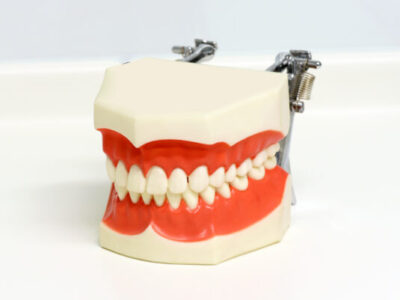 Dental model of upper and lower teeth