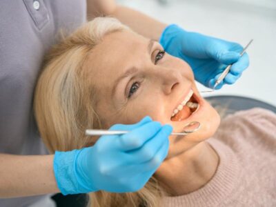 How to Care for Your Veneers and Make Them Last 10+ Years