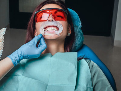 How Professional Teeth Whitening Works